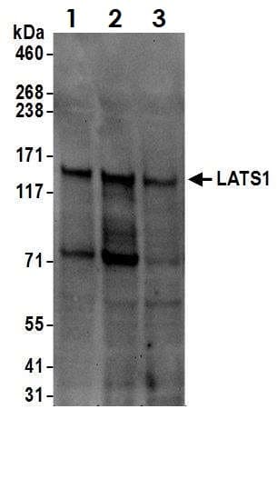 Lats1 Warts Antibody Ab70562  Western Blot Img170808