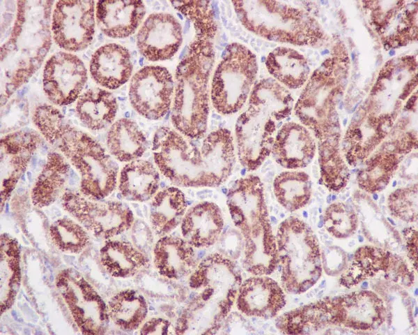 Anti-STAT6 antibody [YE361](AB32520)