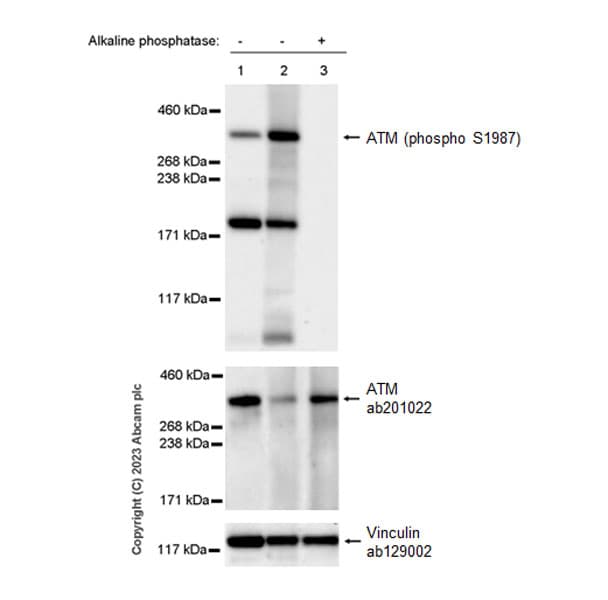 Anti-ATM antibody [EPR20100] - ChIP Grade(AB201022)