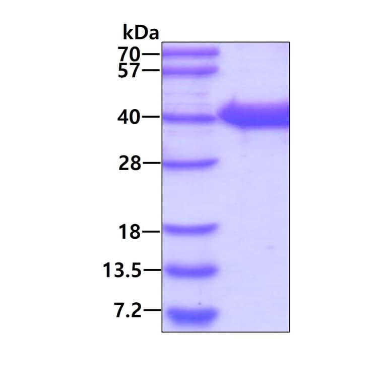 Recombinant Human HIF-1 alpha protein(AB48734)