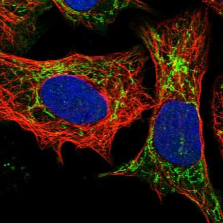 Anti-GST3 / GST pi antibody(AB259373)