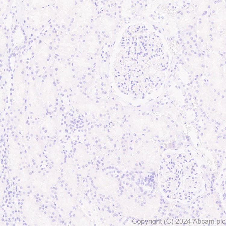 Anti-EBV Nuclear Antigen/EBNA1 antibody [EPR28706-78] - BSA and Azide free(AB316861)