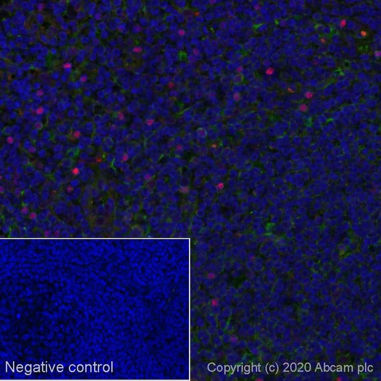Alexa Fluor 594 Foxp3 Antibody Sp97 Ab275080  Immunohistochemistry Formalin Pfa Fixed Paraffin Embedded Sections Img102143