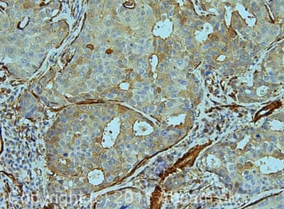 Anti-NOTCH3 antibody(AB23426)