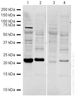 Anti-Glutathione Peroxidase 1 antibody(AB22604)