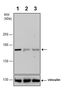 Anti-ROCK2 (phospho S1366) antibody(AB228008)