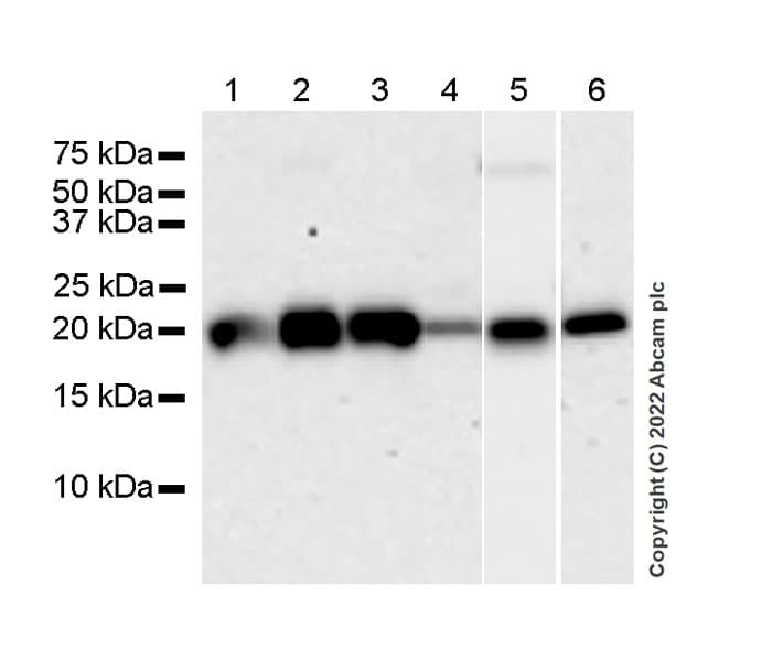 Anti-RBP1 antibody [42/RBP](AB307683)