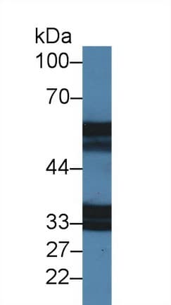 Anti-IL-18R1 antibody(ab231565)
