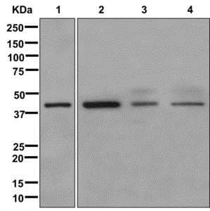 Nudt19 Antibody Epr13162 106 Ab180167  Western Blot Img32750