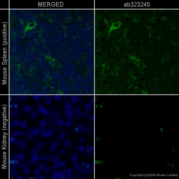 Rabbit Monoclonal H26 10 Human Igg1 H L Alexa Fluor 488 Ab200622  Immunohistochemistry Formalin Pfa Fixed Paraffin Embedded Sections Img440857
