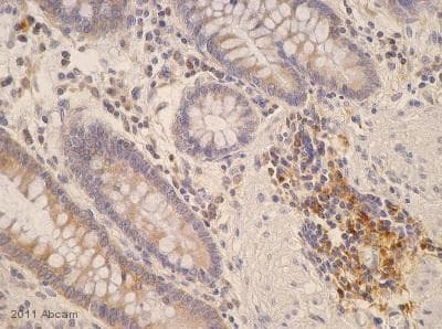 Anti-MHC Class II antibody [6C6](AB55152)