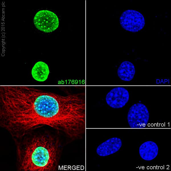 Anti-Histone H3 (tri methyl K9) antibody [EPR16601] - ChIP Grade(AB176916)