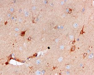 Cystatin C Antibody Epr4413 Ab109508  Immunohistochemistry Formalin Pfa Fixed Paraffin Embedded Sections Img61702