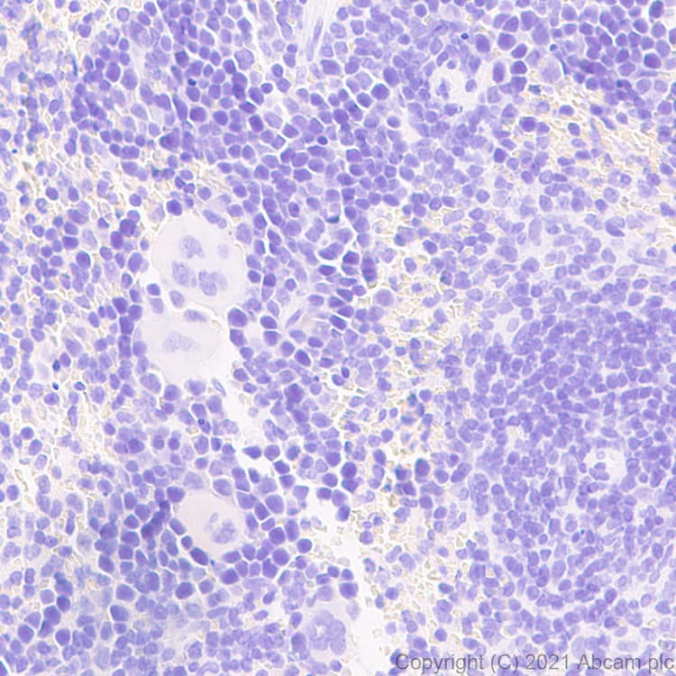 Anti-IL-1 beta antibody [RM1009](AB283818)