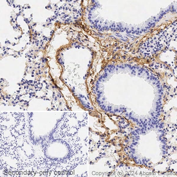 Avidin/Biotin Blocking Kit(ab64212)