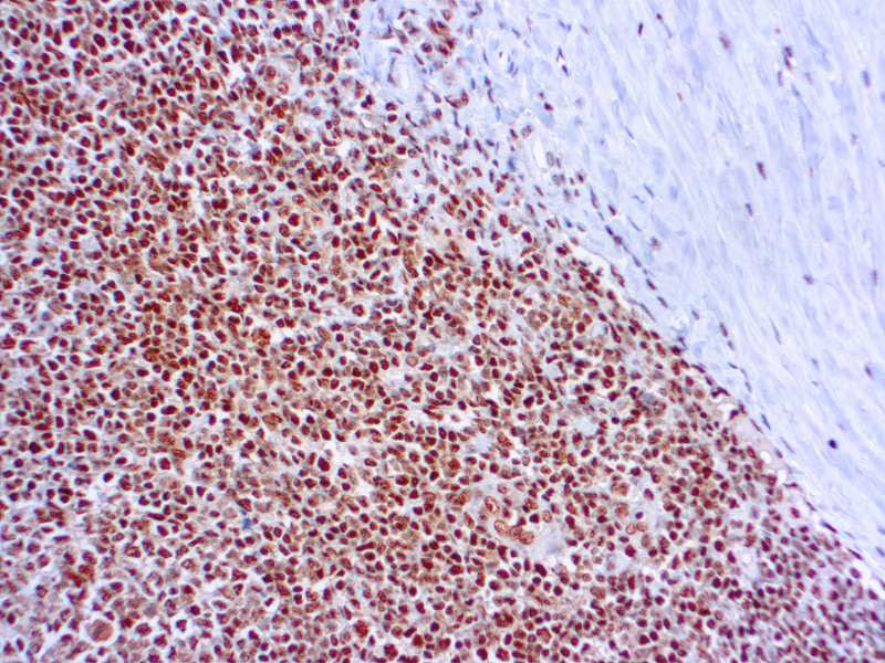 Rpa32 Rpa2 Antibody 9h8 Ab2175 Immunohistochemistry Formalin Pfa Fixed Paraffin Embedded Sections Img134502