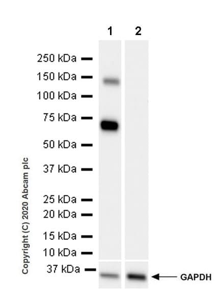 Anti-ALPPL2 antibody [EPR20905-21](AB235581)