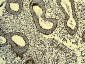 Gc1q R Antibody Epr8870 Ab134926  Immunohistochemistry Formalin Pfa Fixed Paraffin Embedded Sections Img108836
