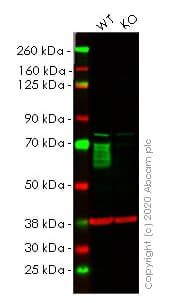 Anti-GBA antibody [EPR5143(3)] - BSA and Azide free(AB215260)