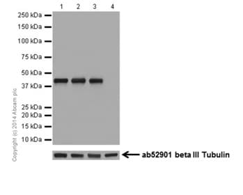 Anti-GATA1 antibody [EPR17362] - ChIP Grade(AB181544)