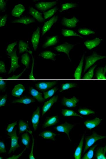 Beta 2 Microglobulin Antibody Ab175031  Immunocytochemistry Immunofluorescence Img113900