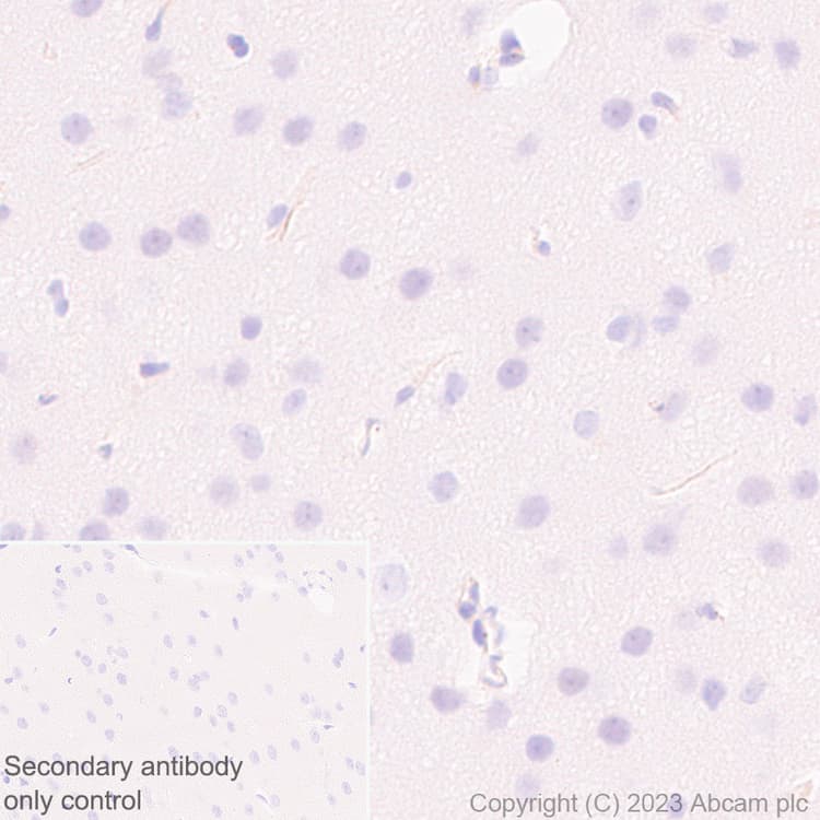 Fyco1 Antibody Epr28361 79 Bsa And Azide Free Ab316013  Immunohistochemistry Formalin Pfa Fixed Paraffin Embedded Sections Img426126