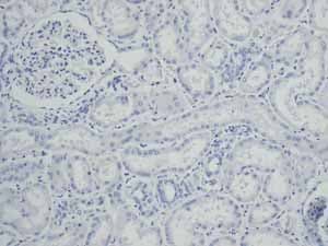 Anti-TNNC1 antibody [EPR9692(B)] - BSA and Azide free(AB248838)