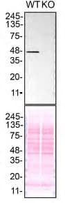 Anti-TDP43 antibody [EPR5810](AB109535)