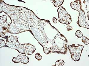 Anti-Calreticulin antibody [EPR3924] - ER Marker(AB92516)