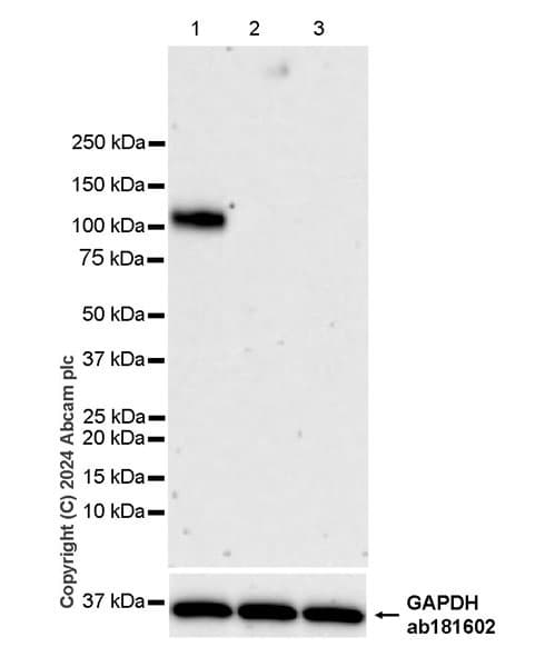 Cd34 Antibody Rm2052 Bsa And Azide Free Ab317589  Western Blot Img431318