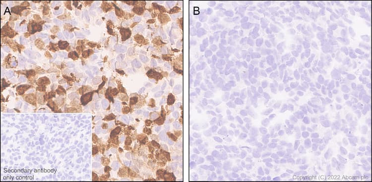 Anti-Strep-tag II antibody [EPR28119-43](AB307676)