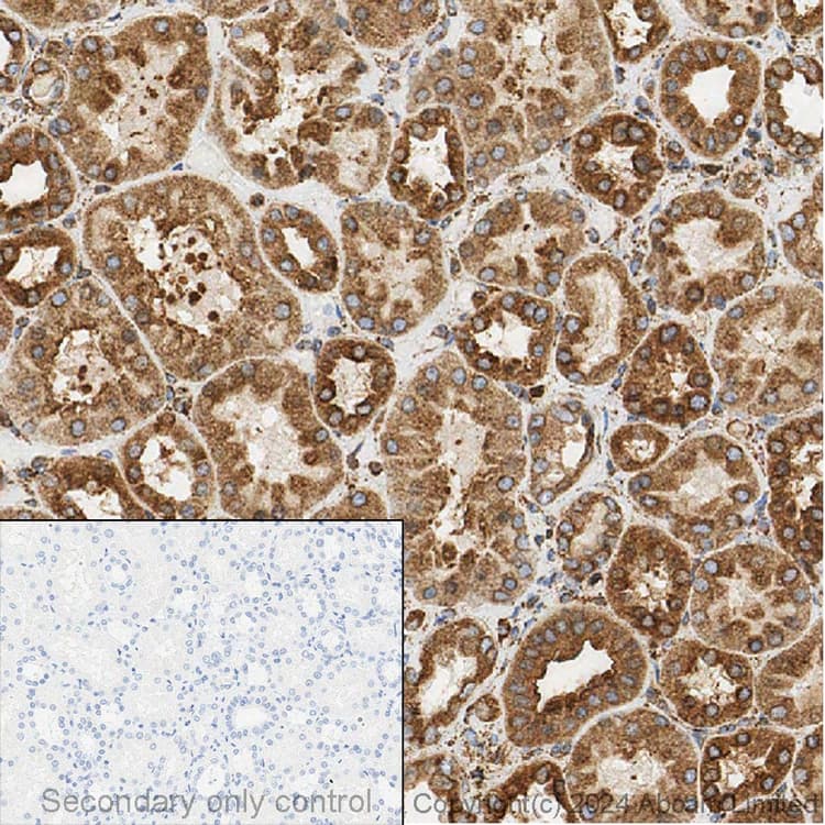 Anti-Calreticulin antibody [EPR3924] - ER Marker(AB92516)