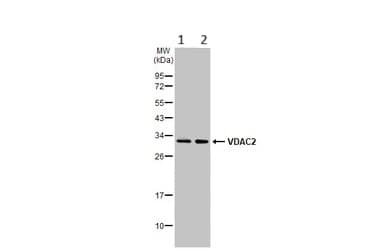 Anti-VDAC2 antibody - C-terminal(AB155803)