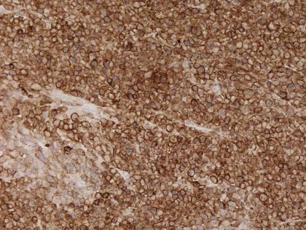 Universal HIER antigen retrieval reagent (10X)(AB208572)