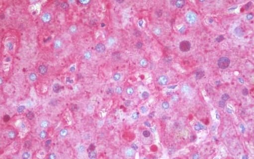 Anti-alpha 1 Antitrypsin antibody [11G2](AB230695)