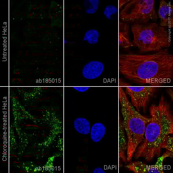 Alexa Fluor® 488 Anti-SQSTM1 / p62 antibody [EPR4844] - Autophagosome Marker(AB185015)