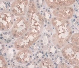 Hemojuvelin Antibody C6 Ab239495  Immunohistochemistry Formalin Pfa Fixed Paraffin Embedded Sections Img66723
