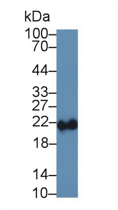 Anti-Ferritin Heavy Chain antibody(AB231253)