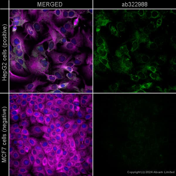 Alexa Fluor 594 Alpha Tubulin Antibody Ep1332y Microtubule Marker Ab202272  Immunocytochemistry Immunofluorescence Img440904