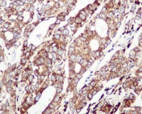 Grp94 Antibody Epr3988 Ab108606  Immunohistochemistry Formalin Pfa Fixed Paraffin Embedded Sections Img125868