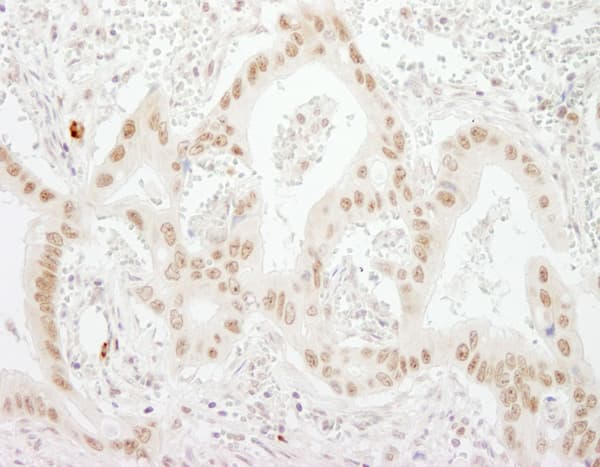 Mtr4 Antibody Ab70551  Immunohistochemistry Formalin Pfa Fixed Paraffin Embedded Sections Img123538