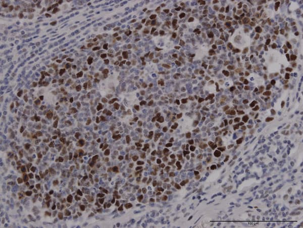 Anti-SOX9 antibody [3C10] - BSA and Azide free(AB76997)