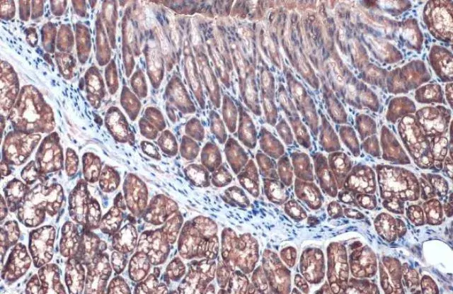 Anti-Villin antibody(AB97512)