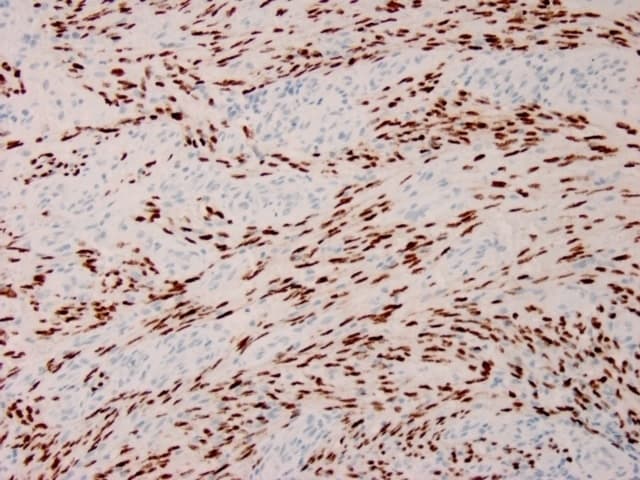 Anti-HHV8 antibody [HHV8/3633R](AB267352)