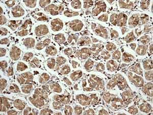 Anti-Calreticulin antibody [EPR3924] - ER Marker(AB92516)