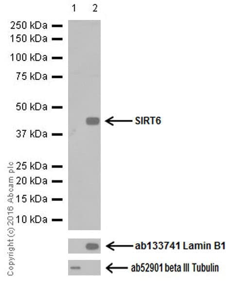 Anti-SIRT6 antibody [EPR18463](AB191385)