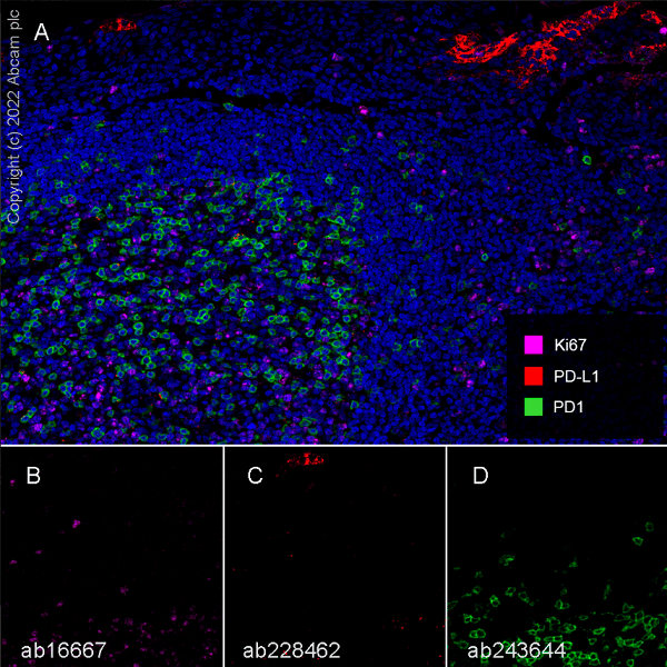 Anti-PD-L1 antibody [SP142] - BSA and Azide free(ab236238)