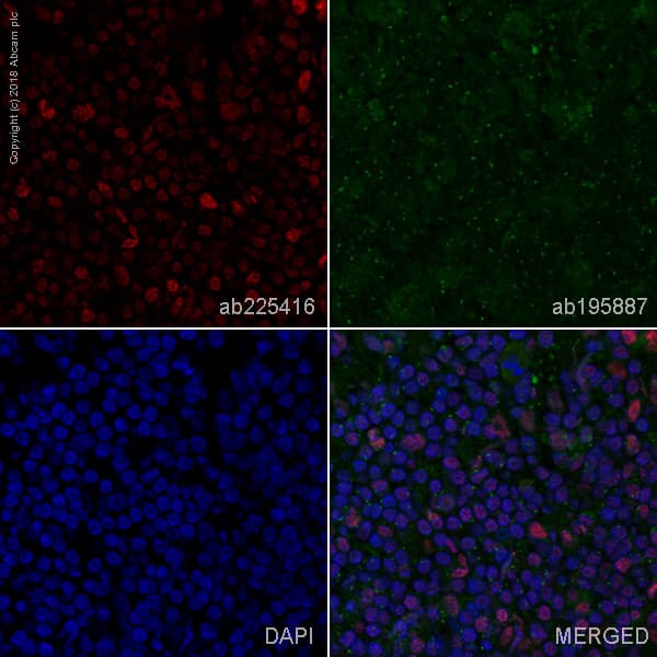 Alexa Fluor 647 C Maf Antibody Epr16484 Ab225416  Immunohistochemistry Frozen Sections Img95376