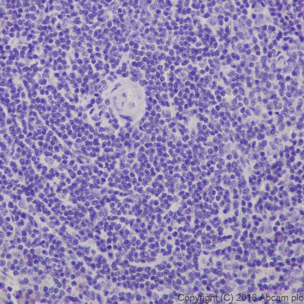 Anti-CRISPR-Cas9 antibody [EPR19620](AB202638)