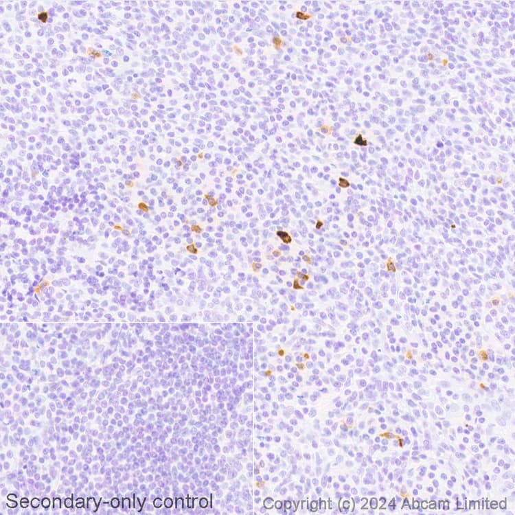 Avidin/Biotin Blocking Kit(ab64212)